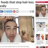Five foods that stop hair loss naturally