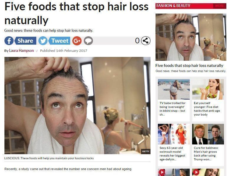 Five foods that stop hair loss naturally Five foods that stop hair loss naturally